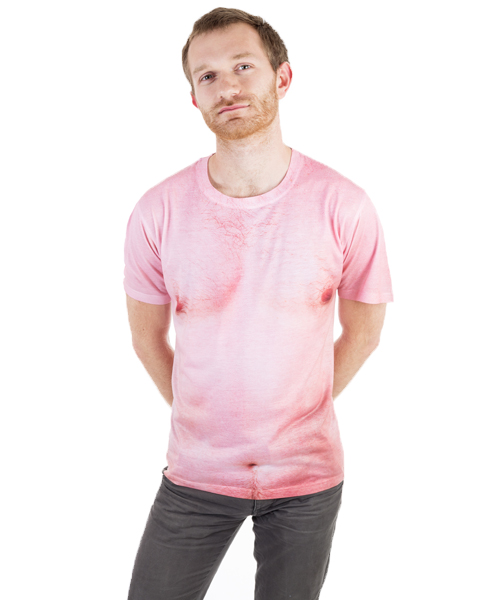 Sonnenbrand T-shirt - Originelle Fotogeschenke